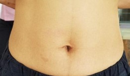 肚脐 在线观看,在线观看肚脐的奇妙世界